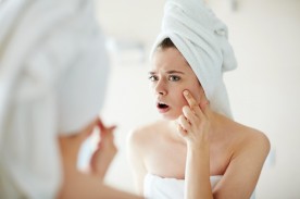 Acne giovanile: Cause sintomi e rimedi naturali