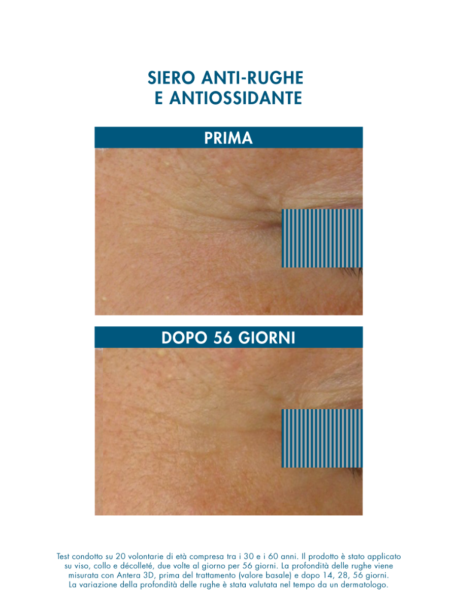 glutathione iv review Glutathione IV: Before and After