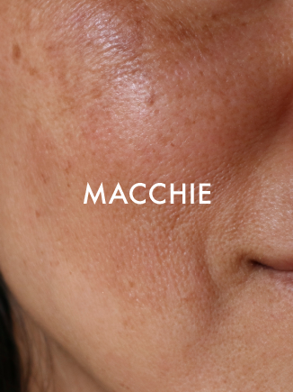 MACCHIE