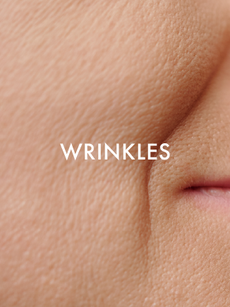 WRINKLES